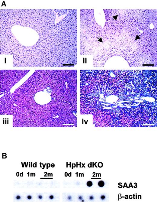 Fig. 7. Analysis of the liver of splenectomized mice. / (A) Liver sections of 2 wild-type (i,iii) and 2 HpHx dKO (ii,iv) mice one month (i-ii) and 2 months (iii-iv) after splenectomy, stained with hematoxylin and eosin (i-ii) and with the Masson trichrome reaction (iii-iv). Note extensive necrotic areas in the liver of HpHx dKO mouse one month after splenectomy (ii; arrows) and massive fibrosis one month later (iv). For all panels, scale bar = 200 μm. (B) Slot blot of total RNA from wild-type (on the left) and HpHx dKO mice (on the right) under basal conditions and one and 2 months after splenectomy, assayed for SAA3 and β-actin expression. Note the strong expression of SAA3 only in HpHx dKO mice 2 months after splenectomy.