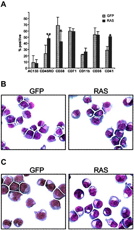 Fig. 3. Immunophenotypic and morphologic analysis. / (A) Immunophenotypic profile of GFP+, CD34+, CD13− cells expressing N-Ras* compared with corresponding controls; day-8 cultures were triple-labeled with antibodies to CD34, CD13, and to one of the determinates indicated. Error bars represent SD (n = 4); *P < .05, **P < .01. (B) Morphology of day-8 cultures and (C) morphology of CD34+cells from day-8 cultures. In each case, cytospin preparations were stained with Wright-Giemsa (original magnification × 400). Note: Vacuolization is a common feature of cultured human erythroblasts.