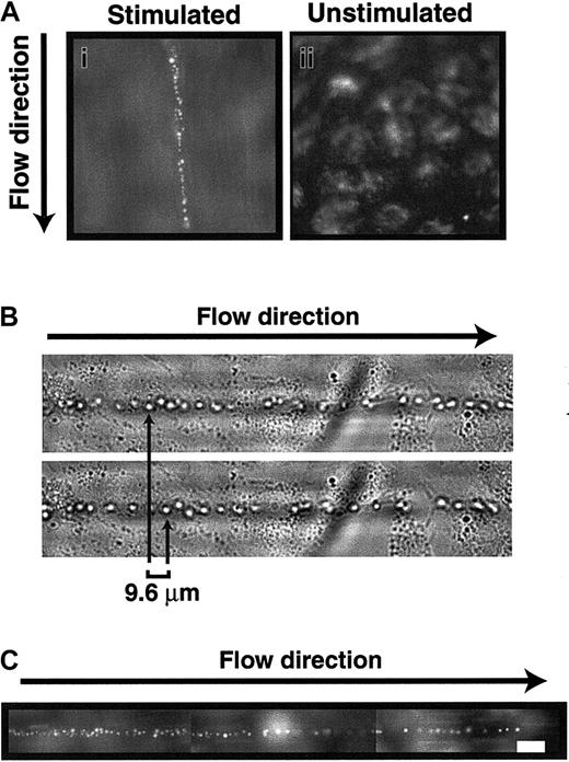 Fig. 2. Platelet adhesion on stimulated endothelial cells. / Washed normal platelets were perfused at a constant shear stress of 2.5 dyne/cm2 over a monolayer of HUVECs. (A) Long lines of platelets aligned as “beads on a string” above histamine-stimulated (i), but not unstimulated (ii), HUVECs. Original magnification × 400. (B) Platelet strings repeatedly stretch and relax in the fluid stream. (C) The length of strings varied but could be several millimeters long (bar = 100 μm). The figure is representative of 86 separate experiments using HUVECs and platelets from 34 different donors.