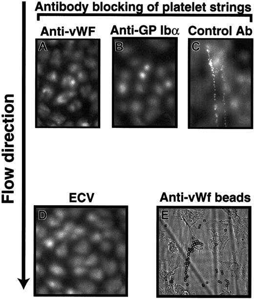 Fig. 3. The strings were formed by tethering platelets to ultralarge VWF multimers via GP Ibα of the GP Ib-X complex. / The formation of strings with adherent platelets was blocked by monoclonal antibodies against either VWF (6G1; A) or GP Ibα (AK2; B) but not by a control mouse IgG (C). Original magnifications × 400. The platelet strings did not form above the surface of endothelial cells incapable of VWF synthesis (ECV304; D). Polystyrene beads coated with a polyclonal anti-VWF antibody also adhered in strings on activated HUVECs (E). Each figure is representative of 4 to 6 separate experiments.