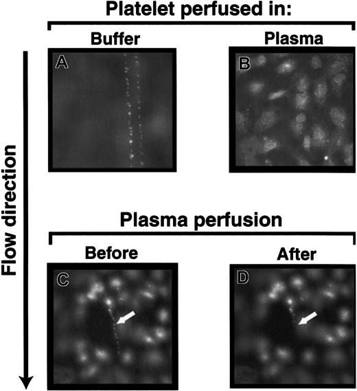 Fig. 6. Normal plasma contains VWF-cleaving activity. / The ULVWF strings with adherent platelets formed when washed platelets (A), but not platelet-rich plasma (B), were perfused over histamine-stimulated HUVECs. The ULVWF strings with adherent platelets that formed by perfusing washed platelets (C; arrow) were cleaved when normal platelet-poor plasma was perfused subsequently (D; arrow). The figure is representative of 28 separate experiments. Original magnifications × 400.