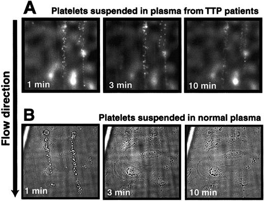 Fig. 8. Plasma from patients with TTP did not cleave the ULVWF strings with adherent platelets. / The ULVWF strings with adherent platelets remained after 10 minutes of perfusion at 2.5 dyne/cm2 of plasma from patients with TTP (A), whereas the strings were rapidly cleaved when normal plasma was perfused (B). The figure is representative of separate experiments carried out using plasma from 14 patients with TTP or 34 healthy donors. Original magnifications × 400.