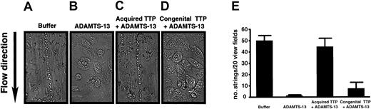 Fig. 9. Effect of TTP plasma on the ULVWF-cleaving activity of ADAMTS-13. / Washed platelets suspended in Tyrode buffer formed the stringlike structures on the stimulated endothelial surface (A), whereas the VWF-platelet strings were cleaved in the presence of purified ADAMTS-13 (B). ADAMTS-13 failed to cleave the VWF strings when it was mixed with plasma from acquired TTP containing anti–ADAMTS-13 antibody (E), but functioned normally when mixed with plasma from congenital TTP with deficient ADAMTS-13 activity (D). Panel E is the summary of multiple sample analyses, and results are expressed as means ± SEM, n = 3.