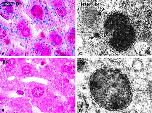 Fig. 2. Iron ferritin in the liver. / Representative sections from the liver of a double-knockout mouse for classical MHC-I molecules(H2Kb−/−Db−/−) (A,C) and from a control B6 mouse (B,D). (A-B) Histological sections stained for ferric iron (Perls); (C-D) ultrathin section of the same liver sample, contrasted with lead citrate. TheH2Kb−/−Db−/− and the B6 mice shown had a hepatic iron concentration of 517 μg/g dry wt and 252 μg/g dry wt, respectively. In the picture representative of the results seen in H2Kb−/−Db−/−mice, the iron was detected in hepatocytes (A), while in B6 mice no stainable iron could be found (B). Although in B6 mice, lysosomes containing some iron ferritin could be visualized (arrows, D),H2Kb−/−Db−/− mice had many lysosomes, with abundant iron ferritin, as well as iron ferritin in the cytoplasm (arrowheads, C). Original magnification × 1000 (A-B); EM magnification × 90 000 (C-D).