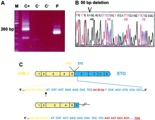 Fig. 1. Eto deletion in one AML1-ETO leukemia case. / (A) AML1-ETO RT-PCR disclosed an abnormal band that was smaller than the typical specific product. M indicates molecular weight marker; C+, positive control; C−, blank sample; and P, patient. (B) Direct sequencing of the abnormal PCR product revealed a 50-bp ETO deletion. (C) Diagram representation of the 50-bp deletion. Only 7 residues of the ETO sequence are conserved in this abnormal chimeric product.