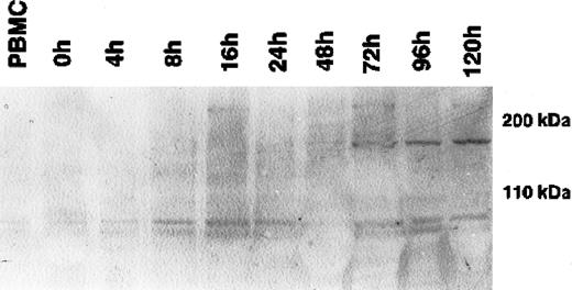 Fig. 1. Western blot analysis of the kinetics of CLIP-170/restin expression during the differentiation of adherent monocytes into dendritic cells. / CLIP-170/restin protein is not detectable using a polyclonal rabbit anti–CLIP-170/restin antiserum in freshly isolated monocytes, but it appears after 72 hours of culture in IL-4– and GM-CSF–supplemented medium and reaches a maximum at day 5.