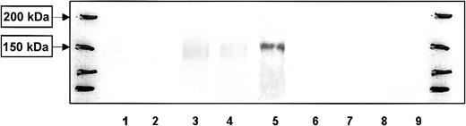 Fig. 2. Western blot analysis of the kinetics of CLIP-170/restin expression during the stimulation of peripheral blood B and T cells. / CLIP-170/restin protein is not detectable using a polyclonal rabbit anti–CLIP-170/restin antiserum in freshly isolated B cells, but it appears after 4 days of culture in IL-4– and CD40L-supplemented medium, whereas CD3 and CD28 activated T cells remain negative. Lane 1, fresh B cells; 2, B cells after 2 days of stimulation with IL4 + CD40 L; 3, B cells after 4 days of stimulation with IL4 + CD40 L; 4, B cells after 10 days of stimulation with IL4 + CD40 L; 5, Hodgkin-derived cell line L540; 6, fresh T cells; 7, T cells 2 days after stimulation with anti-CD3 and anti-CD28; 8, T cells 4 days after stimulation with anti-CD3 and anti-CD28; and 9, T cells 10 days after stimulation with anti-CD3 and anti-CD28. The first and last lanes represent molecular weight markers.