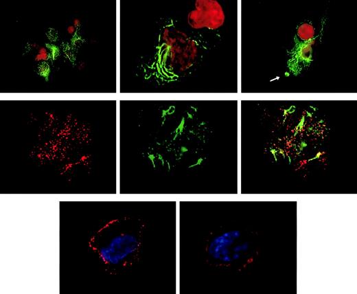 Fig. 3. Subcellular localization of CLIP-170/restin in immature and mature dendritic cells. / (Top row) In immature DCs, CLIP-170/restin appears in numerous large, submembranous and cytoplasmic patches predominantly beneath membrane ruffling sites (arrow). Moreover, in a large proportion of DCs, the protein occurs in thick and branching cytoplasmic bundles, a pattern previously reported exclusively for CLIP-170–cDNA-transfected cells that express very high amounts of the protein. Staining was performed using the CLIP-170/restin-specific monoclonal antibody 2D6 (green). Nuclei were visualized using PI (red). (Middle row) Double staining with 2D6 (red on the left) and microtubule antibodies (green in the middle) demonstrates that CLIP-170/restin aggregates colocalize preferentially with microtubule bundles, indicating the involvement of CLIP-170/restin in microtubule organization (right). (Bottom row) Maturation of DCs with different stimuli leads to dramatic reorganization of CLIP-170/restin with nearly exclusive submembranous localization and loss of centripetal cytoplasmic patches and bundles.
