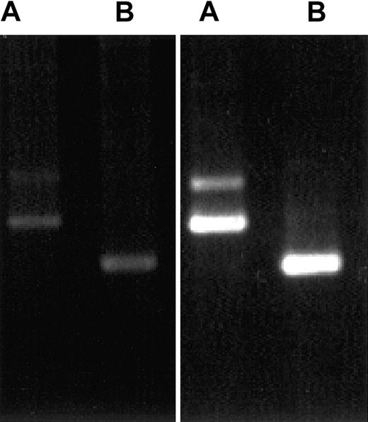 Fig. 4. Demonstration of CLIP-170 and restin expression by differential PCR. / PCR protocols distinguishing between restin and CLIP-170 either because of length differences of their products (A) or by amplifying only restin, but not CLIP-170 (B), reveal that both variants are weakly expressed in PBMCs (left gel) but are strongly expressed in DCs (monocytes after 90 hours of culture in IL-4 and GM-CSF; right gel).