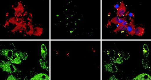 Fig. 5. Association of CLIP-170/restin with macropinosomes. / Monocyte-derived DCs pulsed with labeled dextran particles for 5 minutes to visualize macropinocytosis were stained for CLIP-170/restin after a 10-minute chase. (Top row) Immunofluorescence analysis of FITC-dextran–pulsed DCs (green) stained with a polyclonal rabbit anti–CLIP-170/restin serum (red) combined with DAPI labeling of nuclei (blue) reveals colocalization (yellow) of macropinosomes with regions of CLIP-170/restin enrichment. (Bottom row) Using confocal laser microscopy of DCs stained with monoclonal 2D6 antibody combined with FITC-conjugated secondary antibody (green) after pulsing with Texas Red dextran (red), the association of CLIP-170/restin with macropinosomes was confirmed.