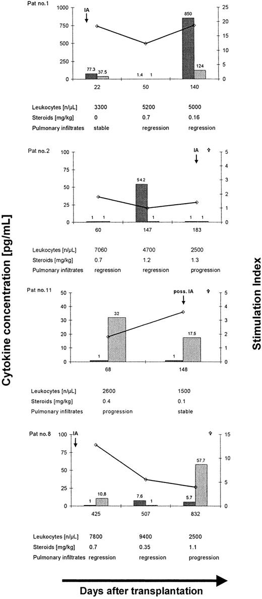 Fig. 4. Longitudinal analysis ofAspergillus-specific T-cell responses in 4 patients with invasive aspergillosis after allogeneic SCT. / Long-term control of invasive aspergillosis was associated with a lymphoproliferative response to EC SAB and a dominant release of IFN-γ (patient no. 1), whereas a low SI (patient no. 2) or a dominant release of IL-10 (patients no. 8 and 11) was found to be associated with disease dissemination and fatal outcome of invasive aspergillosis after allogeneic SCT. ⋄, stimulation index;, IFN-γ; and, IL-10.
