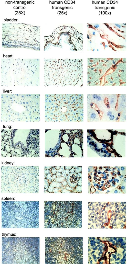 Fig. 4. Human CD34 is expressed in endothelial cells of tissues of transgenic mice. / Expression of human CD34 was detected by immunohistochemistry using a monoclonal antibody against human CD34. The left panels demonstrate lack of staining in tissues from a nontransgenic littermate as a control (original magnification, × 25). The middle panels demonstrate expression of human CD34 protein in transgenic mice at low magnification (original magnification, × 25). The right panels demonstrate expression of the protein in vascular endothelial cells at high magnification (original magnification, × 100).