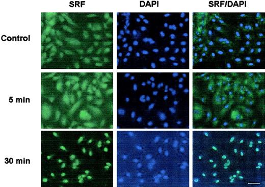 Fig. 8. Thrombin induces the nuclear translocation of SRF in primary endothelial cells. / HPAECs were plated onto 4-well chamber slides, serum-starved overnight, and incubated in the absence (Control) or presence of 1.5 U/mL thrombin for the times indicated. The cells were fixed in ice-cold (4°C) methanol for 10 minutes, washed with PBS, and subsequently incubated with primary anti-SRF antibody, followed by FITC-conjugated second antibody at room temperature. The nuclei were stained with DAPI. Bar, 10 μm. All panels are shown at the same magnification.