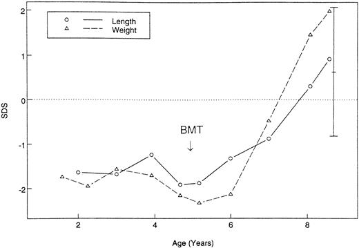 Fig. 3. Growth before and after HSCT of patient 14 with severe pulmonary restriction. / Standard deviation scores of weight and length are shown and compared with target height.