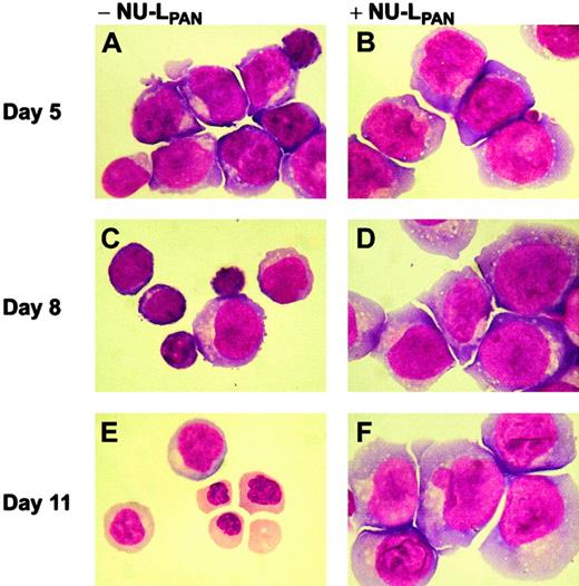 Fig. 3. Morphology of EPO-stimulated CD34+ cells. / CD34+ cells were plated at 1 × 104 cells/mL and cultured in medium containing 5 U/mL EPO, with (B,D,F) or without (A,C,E) the addition of 20 μg/mL NU-LPAN. After 5 to 11 days in culture (as indicated), Wright staining was performed on cytospin smears. Original magnification for all panels, × 125.