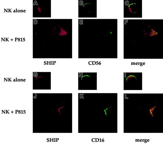 Fig. 5. CD16 receptor and SHIP-1 colocalize after receptor engagement by reverse ADCC. / FITCconjugated anti-CD16– or anti-CD56–treated NK cells were directly fixed (A-C and G-I) or incubated with P815 target cells at 37°C for 3 minutes (D-F and J-L) and then fixed. After fixing, cells were stained with anti-SHIP antibody and Texas red–labeled goat antirabbit IgG. Representative examples of isolated NK cells or NK/P815 conjugates from 3 separate experiments are shown. Cells were analyzed by confocal microscopy. Original magnifications × 600.