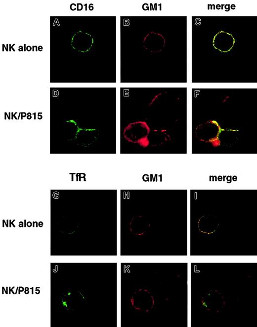 Fig. 7. CD16 receptor and GM1 colocalize after CD16 engagement by reverse ADCC. / FITC-conjugated anti-CD16 or anti-TfR–treated NK cells were stained with Alexa Fluor 594–conjugated CTB and either directly fixed (A-C and G-I) or incubated with CTB-labeled P815 target cells at 37°C for 3 minutes (D-F and J-L) and then fixed. Cells were analyzed by confocal microscopy. Representative example of isolated NK cells or NK/P815 conjugates from 3 separate experiments are shown. Original magnifications × 600.