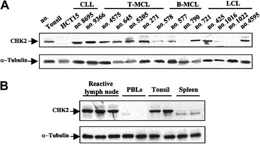 Fig. 2. Western blot analysis of CHK2 protein in NHLs and normal lymphoid tissues. / (A) There were 2 aggressive lymphomas (no. 790 and no. 1022) that lacked CHK2 protein expression. There were 3 additional tumors (no. 578, no. 577, and no. 1016) that showed low levels of expression, whereas the remaining samples had protein levels similar to those observed in normal tonsil. The HCT15 colon cancer cell line was used as negative control. (B) Normal reactive lymphoid tissues showed similar CHK2 protein expression levels, while in normal peripheral blood lymphocytes (PBLs) very low or absent CHK2 expression was detected. Normal spleen samples showed low expression of CHK2 protein with a particular pattern, probably related to phosphorylation differences. Expression of α-tubulin in the same samples used as a loading control is shown in the bottom panels.