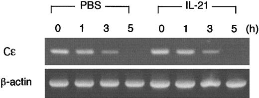 Fig. 8. IL-21 does not accelerate the decay of IL-4–induced germ line Cε transcripts in B cells. / Purified splenic B cells were stimulated with LPS (10 μg/mL) and IL-4 (20 ng/mL) for 15 hours and then incubated with or without IL-21 (10 ng/mL) in the presence of actinomycin D (10 μg/mL) for 1, 3, or 5 hours. Cells were harvested and RT-PCR analysis for germ line Cε transcripts and β-actin (as a control) was performed. Shown are representative data from 3 independent experiments.