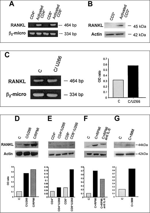 Fig. 1. Effect of myeloma cells on RANKL expression in activated T lymphocytes in cocultures. / Purified CD4+, CD8+, and CD3+ T lymphocytes were activated with coated CD3 plus CD28 mAb. After 4 days mRNA and proteins were tested for RANKL expression by RT-PCR (A) and Western blot analysis (B), respectively. The 24-hour activated CD3+ T lymphocytes were cocultured in a transwell system with HMCLs and RANKL mRNA expression was evaluated in T cells 24 hours later (panel C). Instead RANKL protein was assessed after a further 48 hours of cocultures in activated T cells (D) or activated CD4+/CD8+ subsets (E) and in the presence or absence of anti–IL-6 mAb (F). Similarly, RANKL protein was evaluated in autologous T lymphocytes cocultured with fresh myeloma cells from MM patients (G). The figures are representative of 3 independent experiments; C indicates control (activated CD3+lymphocytes). Graphs represent the mean optical density (OD) of RANKL normalized to OD of β2-microglobulin (panel C) or actin (D-G; named “OD ratio”) of representative experiments.