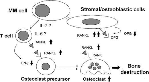 Fig. 7. Model for MM-induced osteoclastogenesis through RANKL induction. / Myeloma cells induce an imbalance in the OPG/RANKL ratio in stromal/osteoblastic cells through the cell-to-cell contact. In addition, myeloma cells stimulate RANKL and down-regulate IFN-γ secretion by T cells at least in part through the direct release of IL-7 or indirect involvement of the high IL-6 levels induced by myeloma cells in the bone environment. The high BM expression and level of the critical osteoclastogenetic factor RANKL associated with lower levels of osteoclastogenetic inhibitors, such as OPG and IFN-γ, may be involved in MM-induced activation of osteoclasts.