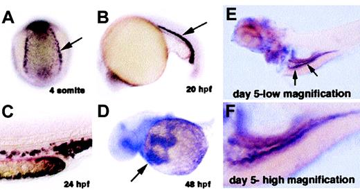 Fig. 3. In situ hybridization staining fordmt1 mRNA. / Dark purple staining indicates expression of dmt1 RNA. (A) Four-somites stage: Posterior-dorsal view of an embryo showing expression in the presumptive blood precursors (arrow). (B) Twenty-somites stage: Lateral view showing expression in immature erythroid cells in the intermediate cell mass (blood island of zebrafish embryo). (C) 24 hpf: High magnification of the tail at 24 hours after fertilization (hpf) showing expression in individual erythroid cells. (D) 48 hpf: View of circulating red blood cells expressing dmt1 RNA (arrow) as they flow over the yolk sac on their way into the heart. (E) Day 5, low magnification: Arrows indicate expression in cells of the embryonic intestine. (F) Day 5, high magnification: Greater detail of the same embryo showing expression of dmt1 RNA in the intestine of a day 5 embryo.
