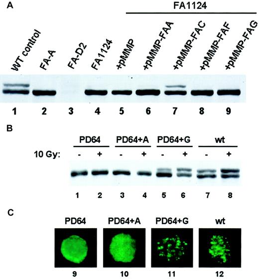Fig. 4. Restoration of FANCD2 monoubiquitination following retroviral transduction provides a rapid Fanconi anemia subtyping assay. / (A) EBV-immortalized lymphocytes from a patient newly diagnosed with FA (FA1124) were transduced with retroviruses carrying vector (lane 5) or the indicated FANC cDNAs (lanes 6-9). Cell lysates were analyzed by FANCD2 immunoblotting. The FANCC retrovirus restored FANCD2 monoubiquitination, consistent with this patient's subtype of FA-C. (B) EBV-immortalized lymphocytes from a patient with known FA-G were infected with pMMP retroviruses containing the FANCA (lanes 3-4) or the FANCG (lanes 5-6) cDNA as indicated. The restoration of FANCD2 monoubiquitination was assessed by immunoblotting. (C) Lymphocytes were also analyzed for restoration of FANCD2 nuclear foci by immunofluorescence (lanes 9-12). Original magnification × 600.