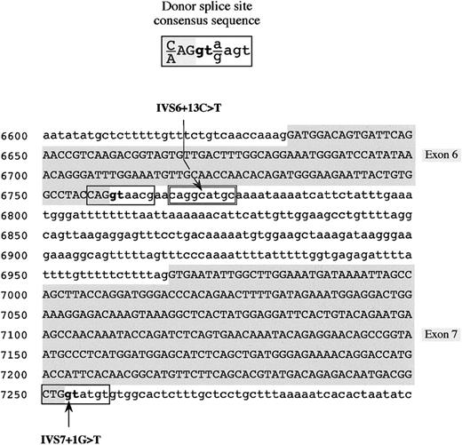 Fig. 2. Mutations in the fibrinogen Bβ-chain gene identified in the 2 afibrinogenemic patients. / Donor splice site consensus sequence16 (top) and partial fibrinogen Bβ-chain gene sequence showing the position of the identified mutations (IVS6 + 13C > T and IVS7 + 1G > T) (bottom) are shown. The genomic Bβ-chain sequence spans from nucleotide positions 6600 to 7299. Identified mutations are indicated by an arrow. Exonic sequences are in uppercase letters and shaded in gray, whereas intronic sequences are in lowercase letters. Physiologic donor splice sites are boxed; the cryptic donor splice site in intron 6 is double-boxed. The invariant GT dinucleotide of the donor splice site is in boldface.