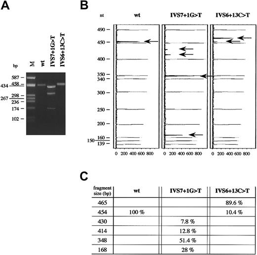 Fig. 3. RT-PCR analysis of wild-type and mutant fibrinogen Bβ-chain mRNAs. / (A) Agarose (2%)-gel electrophoresis of RT-PCR products, amplified from total RNA extracted from HeLa cells after transfection either with IVS6 + 13C > T or IVS7 + 1G > T mutant minigenes. M indicates molecular weight marker (pUC8HaeIII). (B) Analysis of the same RT-PCR products as in panel A, labeled by fluorescent hot-stop technique, separated on an automated DNA sequencer, and analyzed by GeneScan software. In order, from left to right, are shown GeneScan Analysis windows of the capillary-electrophoretic runs of RT-PCR products for the wild-type, IVS7 + 1G > T, and IVS6 + 13C > T minigenes, respectively. Molecular weight standard peaks are in gray; peaks corresponding to the labeled fragments, indicated by arrows, are in black. GeneScan fluorescence units (x-axis) and length of molecular weight fragments (y-axis) are reported. (C) Fragment size and relative amounts of fluorochrome-labeled RT-PCR products, indicated by arrows in panel B, are shown. Molecular weights and peak areas were evaluated by means of GeneScan software. The percentage values correspond to the peak areas, setting the sum of RT-PCR black areas of each experiment equal to 100%.