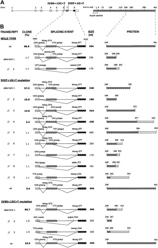 Fig. 4. Effects of IVS6 + 13C > T and IVS7 + 1G > T mutations on splicing of mRNA molecules and on predicted proteins. / (A) Left: schematic representation of the fibrinogen Bβ-chain gene showing the position of the 2 identified mutations. Exons (numbered) and introns are indicated by boxes and lines, respectively, and are drawn to scale. The white part of the box representing exon 8 corresponds to the 3′UTR. Right: schematic representation of the fibrinogen Bβ chain. Numbers refer to amino acid positions at exon/exon boundaries. The last number (461) corresponds to the C-terminal amino acid. Numbering omits the signal peptide. (B) Left: schematic representation of the splicing events produced in HeLa cells transfected with the pT-Bβ-wt, pT-Bβ-IVS7 + 1G > T, and pT-Bβ-IVS6 + 13C > T constructs. RT-PCR products, amplified from total RNA of transfected cells, were subcloned and sequenced. A region of the Bβ-chain gene spanning from exon 6 (nucleotide position 6633) to exon 8 (nucleotide position 8102) is represented for each splicing event. Exons and introns are indicated by boxes and lines, respectively, and are drawn to scale. For each splicing event, used donor and acceptor splice sites are shown; nucleotides retained in each mature mRNA are indicated in uppercase letters. Clone frequencies (indicated as percentage value; left) and RT-PCR product size (right) are shown beside each splicing event scheme; boldface type values correspond to RT-PCR products also detected by fluorescent hot-stop RT-PCR. Right: schematic representation of the predicted Bβ-chain polypeptides, corresponding to wild-type and mutant transcripts. Only the C-terminal regions, starting from residue 248, are shown. Rectangles hatched in dark gray represent normal amino acid sequences; rectangles hatched in light gray, aberrant amino acid sequences originating from frameshifts.