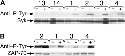 Fig. 5. Phosphorylation of Syk or ZAP-70 in CLL B cells after BCR ligation. / Lysates were prepared before and 10 minutes after BCR ligation with anti-μ F(ab′)2 and then used for immune precipitation with antibodies specific for Syk (A) or ZAP-70 (B). Each pair of lanes represents the lysates prepared from cells before (−) or after (+) BCR ligation, as indicated at the top of each sample lane. The numbers of the CLL samples are provided above each pair of lanes. CLL13 (13) and CLL14 (14) did not express ZAP-70, whereas CLL cases 1 through 4 were ZAP-70+. The top row in panels A and B provides the proteins of approximately 70 to 72 kDa that were detected by antiphosphotyrosine antibody 4G10, as marked by the left-hand arrow labeled “anti–P-Tyr.” The bottom rows in panels A and B provide the same bands identified on the stripped blots that reacted with anti-Syk (Syk) or anti–ZAP-70 (ZAP-70) antibodies, respectively, as indicated by the arrows on the left-hand side of the Figure.