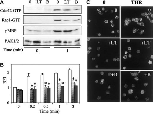 Fig. 4. Effects of LT or toxin B on Cdc42, Rac1, or PAK activation and actin reorganization induced by thrombin. / Prior to stimulation with thrombin for 1 minute, platelets were incubated or not with 1 μg/mL LT or toxin B for 2 hours at 37°C. (A) Pull-down of Cdc42-GTP or Rac1-GTP was performed on PBD-GST, and PAK kinase activity was tested by in vitro phosphorylation of MBP. Quantification of immunoprecipitated PAK was performed by anti-PAK1/2 immunoblot. (B,C) Platelets, preincubated with vehicle (open bars), LT (hatched bars), or toxin B (dark bars), were permeabilized and labeled with 10 μM FITC-phalloidin before analysis by (B) flow cytometry (mean ± SEM; *P < .05) or (C) confocal fluorescence microscopy (× 100). Results are representative of 3 separate experiments.