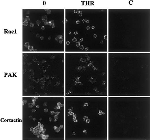 Fig. 7. Immunolocalization of Rac1, PAK, and cortactin in thrombin-stimulated platelets. / Resting or stimulated platelets (0.5 UI/mL thrombin for 1 minute at 37°C) were fixed and labeled with 1-10 μg/mL anti-Rac1 MoAb, anti-PAK1/2 rabbit polyclonal antibody, or anti-cortactin monoclonal antibody for 30 minutes at 4°C. After washes in PBS (pH 7.40), samples were labeled with either secondary goat antimouse antibodies coupled to FITC or secondary goat antirabbit antibodies coupled to rhodamine. Samples were analyzed by confocal fluorescence microscopy (×100). Controls with irrelevant mouse or rabbit IgGs are shown in (C). Results are representative of 3 separate experiments.