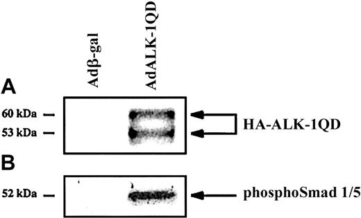 Fig. 1. Expression and constitutive activity of ALK-1QD in HMVEC-d's. / HMVEC-d's were infected for 15 hours with AdALK-1QD or Adβ-gal at an MOI = 10. Cell lysates (20 μg) were immunoblotted with antibodies against HA (A) and phosphoSmad1/5 (B).