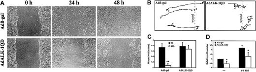 Fig. 3. ALK-1QD inhibits HMVEC-d migration in a wound assay. / (A) At 15 hours after infection, the cell monolayer was scratched to create a wound. At time 0, 24, and 48 hours after wounding, the cells were observed by phase contrast microscopy and photographed. Original magnification, × 50. (B) Comparison of the path of migration of AdALK-1QD and Adβ-gal HMVEC-d infected cells at their initial positions (1-6, time 0, wounding) and at their final positions (1′-6′, 48 hours after wounding). (C) The mean wound width was measured at time 0 (wounding) and 48 hours after wounding (n = 10). D: Infected and labeled cells were placed in transwell filter chambers in 0.5% FBS. The inserts were then placed in 24-well plate in 0.5% or 5% FBS. Fluorescence measurements to assess migration of DiI-labeled cells through the transwell membrane were taken. The mean fluorescence of Adβ-gal–infected cells in 0.5% FBS was set at 1 (mean of 3 experiments performed in triplicates). **P < .01 and *P < .05.