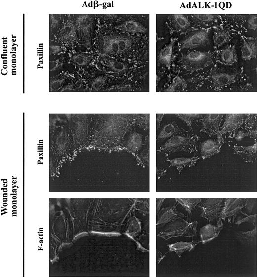 Fig. 6. ALK-1QD inhibits relocalization of paxillin and β-actin at the edge of the wound. / At 15 hours after infection, the monolayer was wounded with a pipet tip (bottom panel) or left unwounded (top panel). After 3 hours, the monolayers were fixed and stained for paxillin and F-actin as described in “Materials and methods.” Original magnification, × 1000.