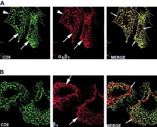 Fig. 4. Laser scanning confocal microscopy analysis revealed CD9 colocalized with integrin α5β1, but not all integrin subunit β1, on the basal surface of subconfluent FN-adherent CHO A6 cells. / Cell cycle–synchronized CHO A6 cells were grown on FN-coated slides for 3 hours, as described in “Materials and methods.” (A) mAb7-labeled CD9 (green) and PB1-labeled α5β1 (red) were located in punctate clusters (large arrows), particularly at the cell margin (arrowheads) and along filipodia. Colocalization of CD9 and α5β1 (yellow) was nearly total. Note the CD9-integrin α5β1–deficient zone just inside the cell margin (small arrows). (B) mAb7-labeled CD9 (green) and 7E2-labeled integrin subunit β1(red) were found in punctate patches, particularly at the cell margin (large arrows) on the basal surface. Most integrin β1colocalized (yellow) with CD9. However, the zone just inside the cell margin previously described as CD9 and integrin subunit α5β1-free contained integrin subunit β1 not colocalized with CD9. Original magnification × 100.