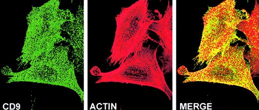 Fig. 6. CD9 and cytoskeletal F-actin are colocalized on the basal surface of subconfluent FN-adherent CHO A6 cells. / Cell cycle synchronized CHO A6 cells were grown on FN-coated slides for 3 hours, as described in “Materials and methods.” Laser scanning confocal microscopy analysis revealed that many of the punctate patches of mAb7-labeled CD9 (green) and phalloidin-TRITC labeled F-actin (red) were colocalized (yellow), particularly at the periphery of the cell body. Original magnification × 100.