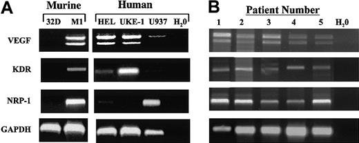 Fig. 1. Expression of VEGF and VEGF receptors in leukemic cells. / RNA was isolated from leukemic cell lines grown in culture (A) and freshly isolated human leukemia cells (B) as described in “Materials and methods.” RT-PCR was performed on the RNA, using primers corresponding for human VEGF, KDR, NRP-1, and GAPDH cDNA sequences and murine Flk-1 (KDR) and NRP-1 cDNA sequences, as indicated. PCR products were resolved on a 2% agarose gel, stained with ethidium bromide, and visualized under UV light.