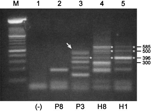 Fig. 3. RT-PCR products of 3′-ends of the coding region of Pax5 transcripts differ between malignant and normal B cell–enriched populations. / Shown are RT-PCR products that were generated with a pair of primers designed to amplify a 585 bp product in the 3′-end of the coding region of Pax5. All templates were mRNA derived from B cell–enriched populations. P indicates MM patient; H, healthy donor. (Lane M) A 100-bp ladder (Boehringer Mannheim). Products of 300 bp or less in this RT-PCR were not readily identifiable. (Lane 1) A no-template control. (Lane 2) An unidentified product for P8. (Lane 3) The uppermost product observed for P3 (arrow) is a doublet composed of a 498-bp product and a 483-bp product that were identified as Pax5 isoforms missing exons 9 and 8, respectively. A product at 396 bp is an isoform missing Pax5 exons 7 and 8 in tandem. (Lanes 4 and 5) Products identified for H3 and H1 include the expected product of 585 bp, a product at 396 bp that is missing exons 7 and 8, and a product at 500 bp that is a mixed hybrid of one strand of the 585-bp and one strand of the 396-bp product.