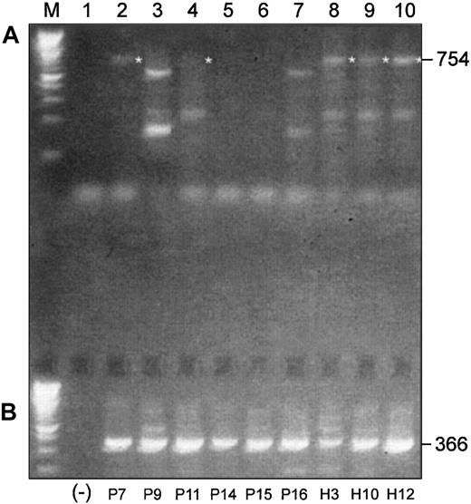 Fig. 4. Differences and similarities are observed in Pax5 isoform usage in malignant and normal B-cell–enriched populations. / (A) RT-PCR products of 3′-ends of the coding region of Pax5 transcripts differ between malignant and normal B cell–enriched populations. (B) Alternative Pax5 d/e is expressed in both malignant and normal B cell–enriched populations. Shown in panel A are RT-PCR products that were generated with a pair of primers designed to amplify a 754-bp product in the 3′-end of the coding region of Pax5. All templates were mRNA derived from B cell–enriched populations. P indicates MM patient; H, healthy donor. (Lane M) A 100-bp ladder (Boehringer Mannheim). (Lane 1) A no-template control. (Lanes 2-7) Patients P9, P15, and P16 had not yet received any chemotherapy at the time of the BM harvest; patients P7, P11, and P14 had received treatment with chemotherapy at the time of the BM harvest (Table 2). The expected 754-bp product is faintly observed in 2 treated patients (P7 and P11) but in none of the untreated patients. (Lanes 8-10) The expected 754-bp product is expressed in all 3 healthy subjects. All other products observed with this primer pair were nonspecific. (B) (Lane 1) A no-template control. (Lanes 2-10) All MM patients, treated and untreated, and all healthy subjects express the alternative Pax5d/e isoform.