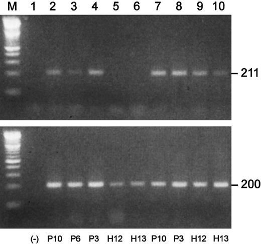 Fig. 8. Blimp-1 is prematurely expressed in B-cell populations in MM. / Semiquantitative gene-specific RT-PCRs were performed to determine relative levels of expression of Blimp-1. Shown is an example of one experiment. P indicates MM patient; H, healthy donor. All upper lanes show Blimp-1 expression; all lower lanes show β-actin expression. (Lane M) A 100 bp ladder (Boehringer Mannheim). (Lane 1) A no-template control. (Lanes 2-6) Blimp-1 products (upper lanes) and β-actin products (lower lanes) generated using mRNA templates extracted from B cells from P10, P6, and P3 and from H12 and H13, respectively. (Lanes 7-10) Blimp-1 products (upper lanes) and β-actin products (lower lanes) generated using mRNA templates extracted from plasma cells from P10 and P3 and from H12 and H13, respectively.