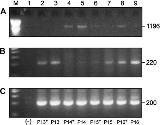 Fig. 9. Blimp-1 is expressed in CD22+ and CD22− B cells, and its expression is inversely correlated to Pax5 expression in the same cells. / P indicates MM patient. Superscripts “+” and “−” designate CD22+ and CD22− B cells, respectively. (Lane M) A 100 bp ladder (Boehringer Mannheim). (Lane 1) A no-template control. (A) Full-length Pax5 expression in CD22+ and CD22− B-cell populations from 4 patients. (B) Accompanying Blimp-1 expression in the same cell samples as panel A. (C) A β-actin control.