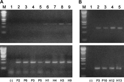 Fig. 10. A1 expression correlates inversely to Blimp-1 expression in B cells and plasma cells from MM patients and healthy donors. / Semiquantitative gene-specific RT-PCRs were performed to determine relative levels of expression of A1 in B cells and plasma cells from both malignant and healthy subjects. P indicates MM patient; H, healthy donor. (A) (Lane M) A 100 bp ladder (Boehringer Mannheim). (Lane 1) A no-template control. (Lanes 2-9) A1 products (upper lanes) and β-actin products (lower lanes) generated using mRNA templates extracted from percursor B cells from P2, P6, P3, P5, H1, H4, H3, and H9, respectively. (B) (Lane M) A 100-bp ladder (Boehringer Mannheim). (Lane 1) A no-template control. (Lanes 2-5) A1 products (upper lanes) and β-actin products (lower lanes) generated using mRNA templates extracted from plasma cells from P3, P10, H12, and H13, respectively.