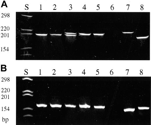 Fig. 2. TCR-γ PCR of isolated single CD30+ cells and single CD30− cells (polyacrylamide gel stained with ethidium bromide, PAGE 6%). / (A) TCR-γ PCR products obtained with primers covering Vγ gene segments 1 to 8. CD30+ cells (lanes 1-5). Initial biopsy of patient no. 2 (lanes 1, 3, 4); biopsy taken 52 months later (lanes 2, 5). Note the biallelic rearrangement in this patient. Simultaneous detection of both rearrangements is only in lane 3, whereas lanes 1 and 2 and lanes 4 and 5 represent either 1 of the 2 rearranged alleles, respectively. Negative control (lane 6). Reactive CD30−cells of patient no. 2 (lanes 7, 8). (B) TCR-γ PCR products obtained with primers covering Vγ gene segment 10. CD30+ cells of patient no. 8 (lanes 1-5). Negative control (lane 6). Reactive CD30− cells of patient no. 8 (lanes 7, 8).