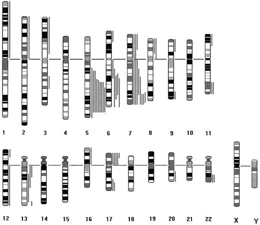 Fig. 2. Schematic representation of the partial deletions observed among the 30 children and 23 adults. / Vertical solid bars located on the right of each chromosome (R-band diagram) represent the size of each deletion.