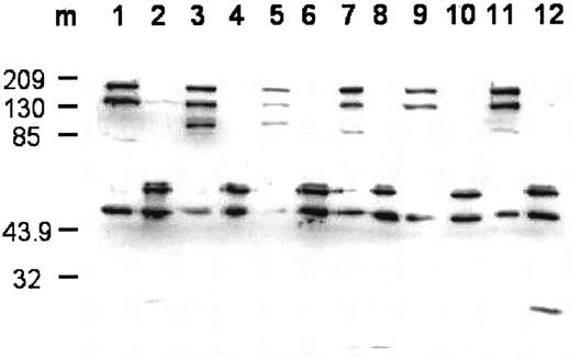 Fig. 1. Western blot of expressed wild-type and mutant FVIII and cleavage by thrombin. / The blot was probed using monoclonal antibody R8B12, which recognizes an epitope within the A2 domain. Lane designations are: 1 and 2, FVIIIWT and FVIIIaWT; 3 and 4, FVIIISer558Phe and FVIIIaSer558Phe; 5 and 6, FVIIIVal559Ala and FVIIIaVal559Ala; 7 and 8, FVIIIAsp560Ala and FVIIIaAsp560Ala; 9 and 10, FVIIIArg562Ala and FVIIIaArg562Ala; 11 and 12, FVIIIGln565Arg and FVIIIaGln565Arg. Lane m shows the positions for the protein markers (Mr is ×10−3).