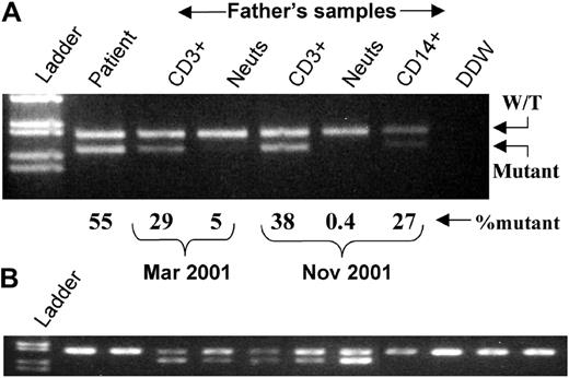 Fig. 1. Mismatch PCR and restriction enzyme analysis. / (A) DNA prepared from total white blood cells from the patient and purified cellular fractions from the father. Percentages of mutant DNA are derived from radioactive PCR analysis. Cell purity (November only): CD3+, greater than 98%, CD14+, 85% (by flow cytometry); neutrophils, greater than 97% (400 cell differential). (B) Representative individual erythroid colonies grown in vitro from the father's blood mononuclear cells. Neuts indicates neutrophils; W/T, wild-type; DDW, double deionized water.