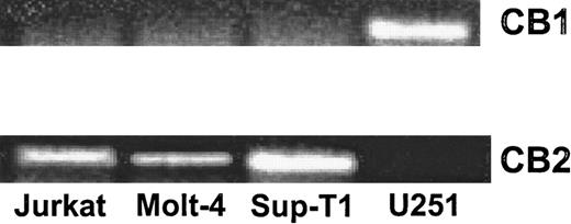 Fig. 7. The expression of CB1 and CB2 mRNA in Molt-4, Jurkat, Sup-T1, and U251 human tumor cells. / The expression of CB1 and CB2 was determined by RT-PCR analysis. Total RNA was isolated from Molt-4, Jurkat, Sup-T1, and U251 tumor cells. mRNA was reverse transcribed and amplified by PCR with primers specific for CB1 and CB2. A photograph of ethidium bromide–stained amplicons is depicted.