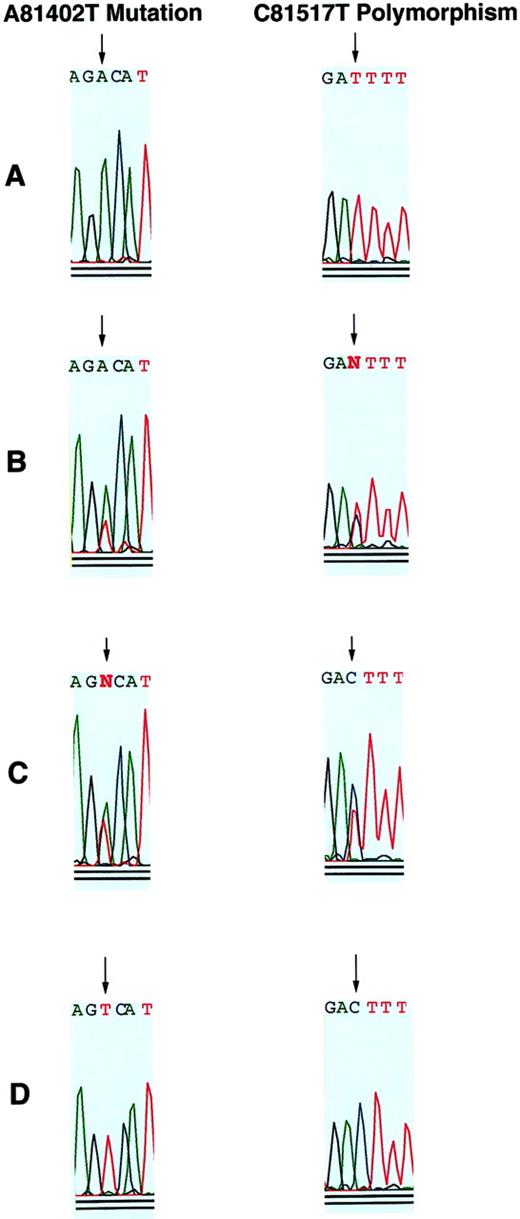 Fig. 1. Demonstration of the A81402T (Asp816Val) mutation and C81517T (81517C>T) polymorphism of c-kit in 187 individual mast cells by single-cell PCR amplification of genomic DNA followed by sequencing. / The regions containing the mutation and the polymorphism in the same electropherogram from 4 individual bone marrow mast cells (A-D) are shown. Panel A is typical of 12 of 187 cells in which the mutation but not the polymorphism was detected. Panels B and C are typical of 149 of 187 cells in which both the polymorphism and the mutation were detected. Panel D is typical of 26 cells in which the polymorphism but not the mutation was detected.